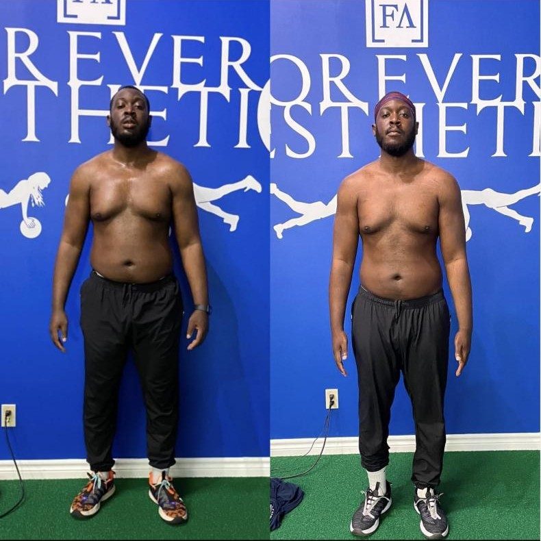 Bobby's before and after photos