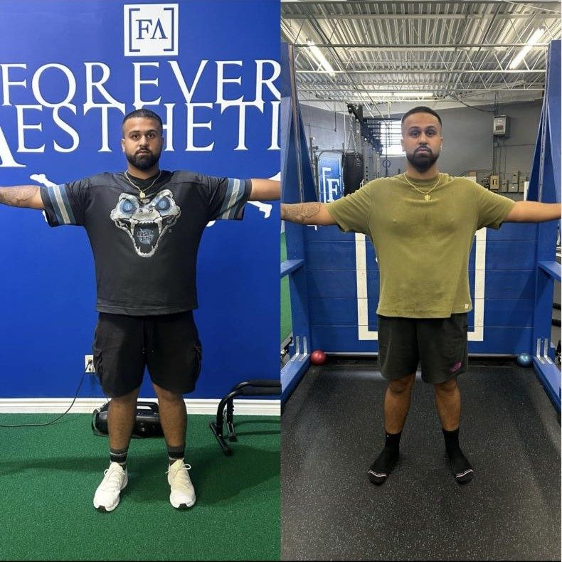 Jasjit's before and after photos