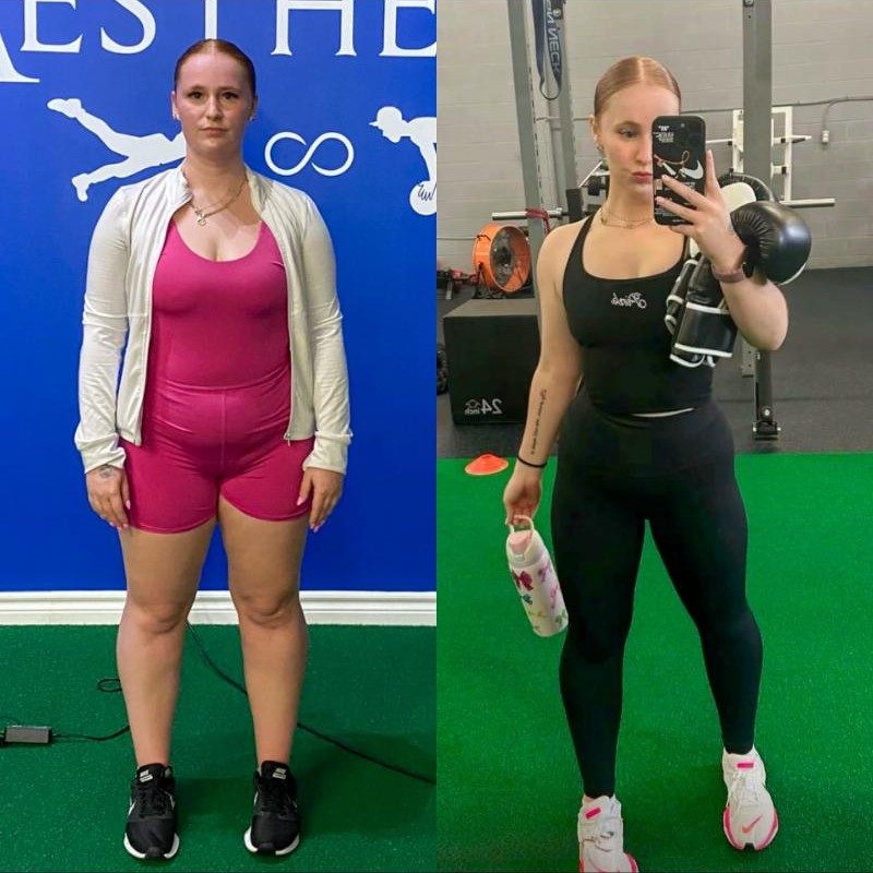 Kloe's before and after photos