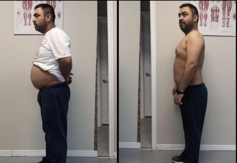 Ron's before and after photos